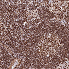 Anti-ZC3H18 Antibody