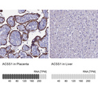 Anti-ACSS1 Antibody