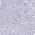 Anti-CCDC86 Antibody