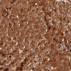 Anti-ACSM5 Antibody