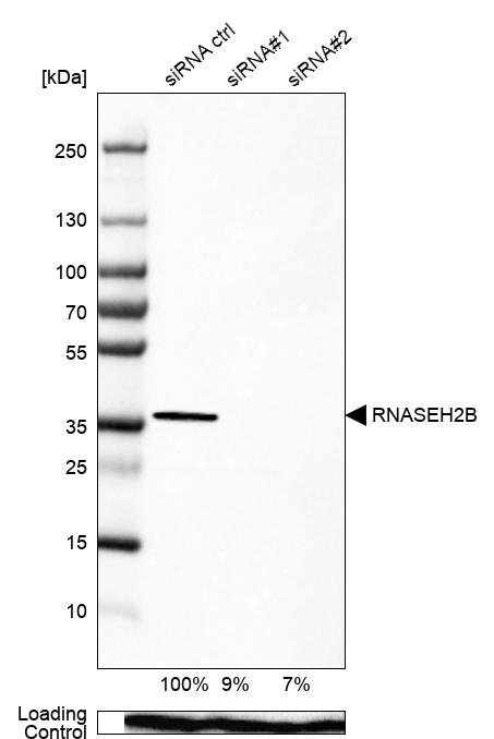Anti-RNASEH2B Antibody