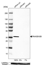 Anti-RNASEH2B Antibody