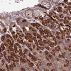 Anti-SLC15A5 Antibody