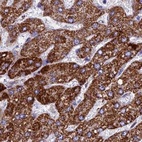 Anti-UQCRFS1 Antibody
