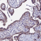 Anti-GPR108 Antibody