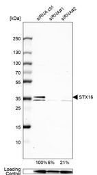 Anti-STX16 Antibody