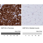 Anti-AQP12A Antibody