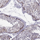 Anti-CT47A1 Antibody