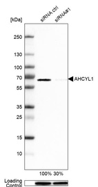 Anti-AHCYL1 Antibody