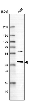 Anti-RNF166 Antibody