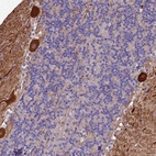 Anti-MFSD2A Antibody