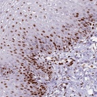 Anti-MFSD10 Antibody