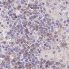 Anti-FAM168B Antibody