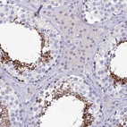 Anti-GOLGA6A Antibody