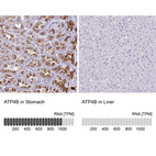 Anti-ATP4B Antibody