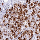 Anti-CELA3A Antibody