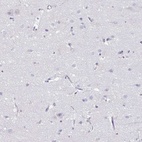 Anti-PGLYRP1 Antibody