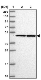 Anti-SGK494 Antibody