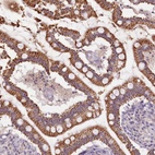 Anti-CAPN7 Antibody