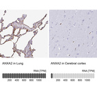 Anti-ANXA2 Antibody