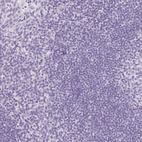 Anti-IGFBP1 Antibody