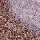 Anti-SAMHD1 Antibody