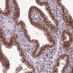 Anti-PRPF6 Antibody