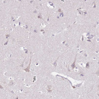 Anti-MRPL36 Antibody