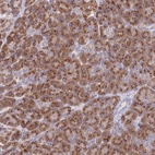 Anti-MRPL30 Antibody