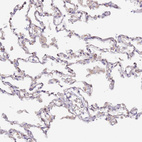Anti-HSD17B7 Antibody