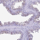 Anti-LRRC10B Antibody