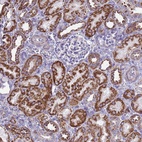 Anti-RNF165 Antibody