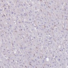 Anti-PLPP1 Antibody