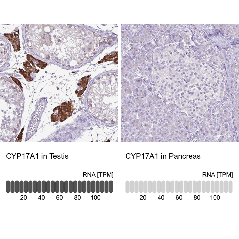 Anti-CYP17A1 Antibody