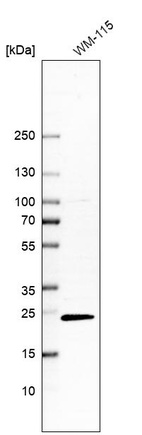 Anti-C19orf71 Antibody