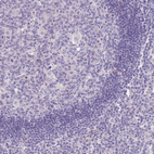 Anti-TINAGL1 Antibody