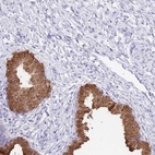 Anti-OR2Z1 Antibody