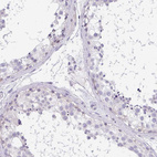 Anti-CACNA1S Antibody