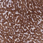 Anti-RNF222 Antibody