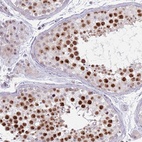 Anti-MRPL34 Antibody