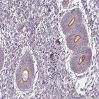 Anti-SLC16A9 Antibody
