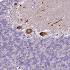 Anti-PSRC1 Antibody