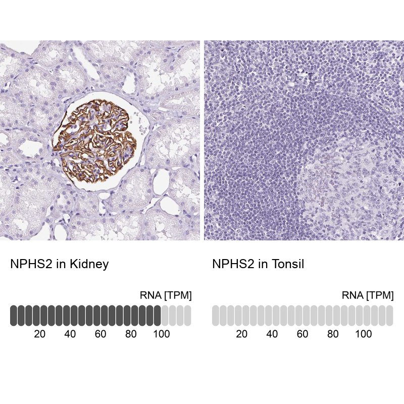 Anti-NPHS2 Antibody