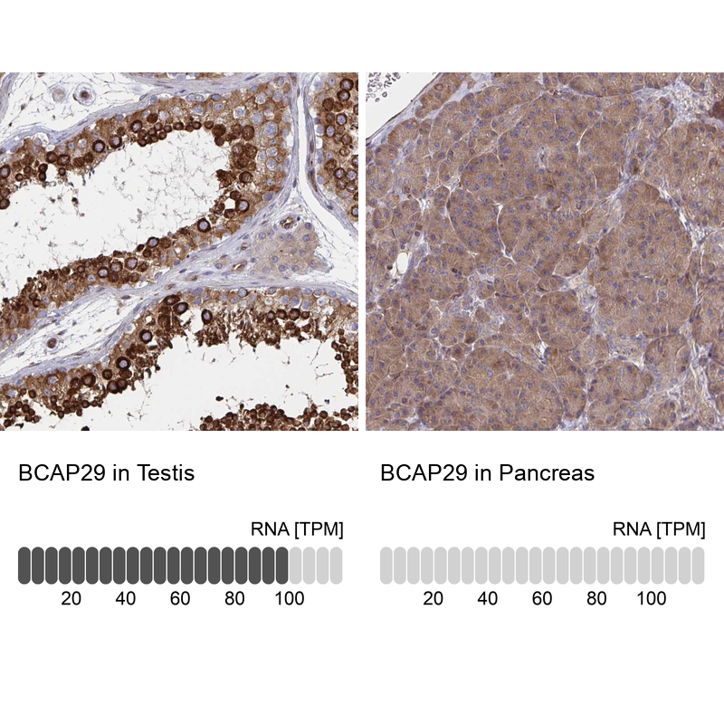Anti-BCAP29 Antibody