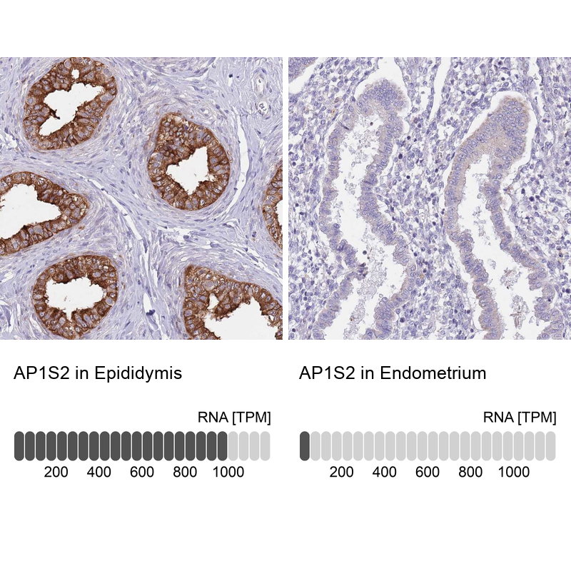 Anti-AP1S2 Antibody