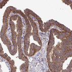 Anti-FMR1 Antibody