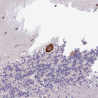 Anti-KCTD16 Antibody