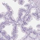 Anti-TMEM38A Antibody