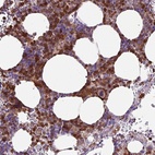 Anti-TMEM8A Antibody