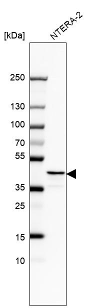 Anti-RAD51AP1 Antibody